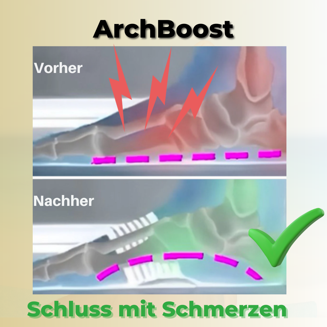 ArchBoost